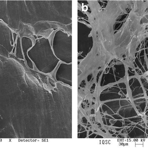 Scanning Electron Microscopy Photomicrographs Of The Membranes A