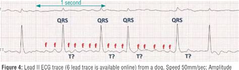 Figure 4 From Diagnosis And Management Of Supraventricular Tachycardias Semantic Scholar