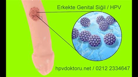 Genital Si Il Tedavisi Erkeklerde Nemli Mi Genital Si Il E Tedavisi