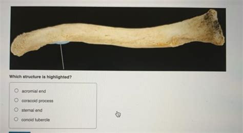 Solved Which structure is highlighted? O acromial end O | Chegg.com