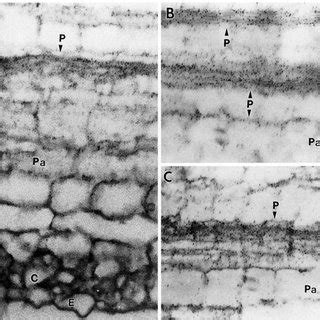 A C Light Microscope Autoradiograph Of Longitudinal Sections Of