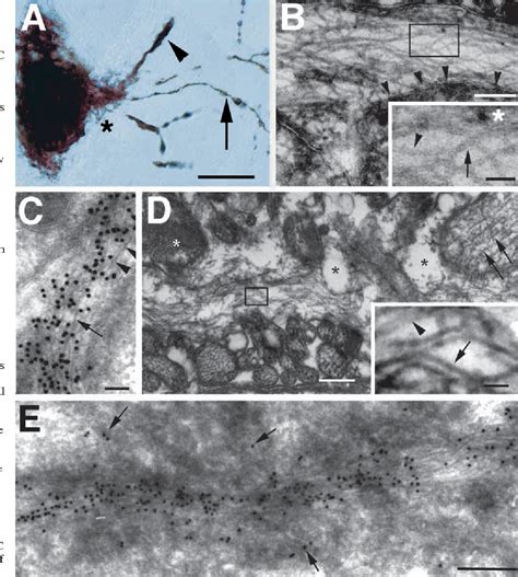 Figure 1 From Human Tau Filaments Induce Microtubule And Synapse Loss