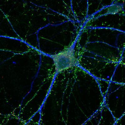 Neuron Glia Coculture Stained Image Eurekalert Science News Releases