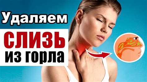 Как убрать слизь в горле народными средствами и вылечить мокроту