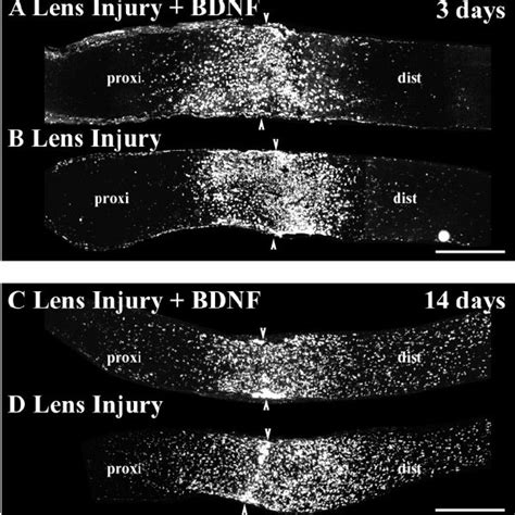 Bdnf Does Not Alter Macrophage Activation And Infiltration In The Optic