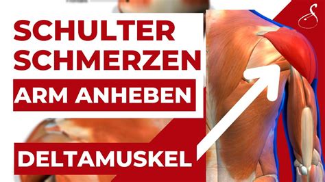 Schulterschmerzen Beim Arm Anheben Deltamuskel Schmerzen SanoGym