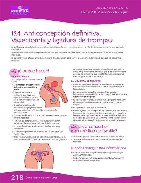 Vasectomía Guía Práctica De La Salud