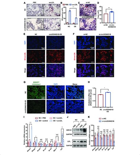 CircDENND1B Regulates Foam Cell Formation By Promoting Cholesterol