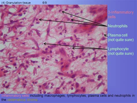 Granulation Tissue Histology