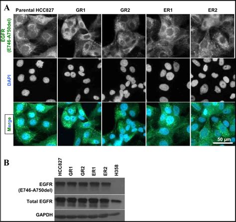 Upregulation Of Bcl2 In NSCLC With Acquired Resistance To EGFRTKI