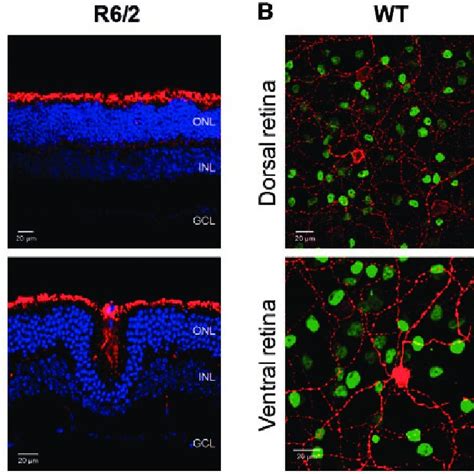 Time Course Of Cone Opsin And Melanopsin Expression In R Mice A