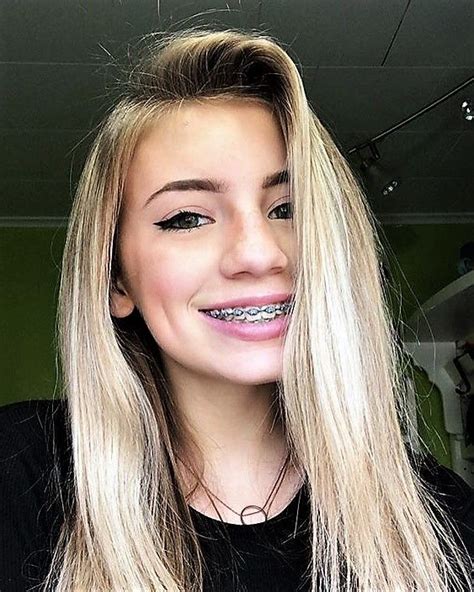 Pin By John Beeson On Girls In Braces Braces Girls Blonde Hair Girl