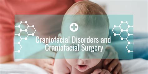 Craniofacial Disorders And Craniofacial Surgery Dubai Clinics