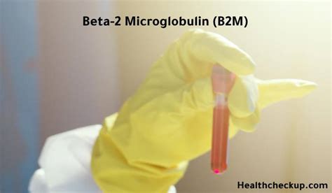 Beta 2 Microglobulin (B2M) Blood Test: Low, High, Normal Levels