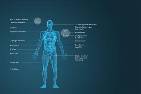 Medical Implant Market Size Share Analysis Key Companies And