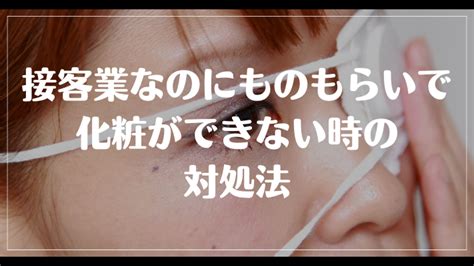 ものもらいで仕事を休むのはあり？接客業で化粧ができない時の対処法 ヤメドキ