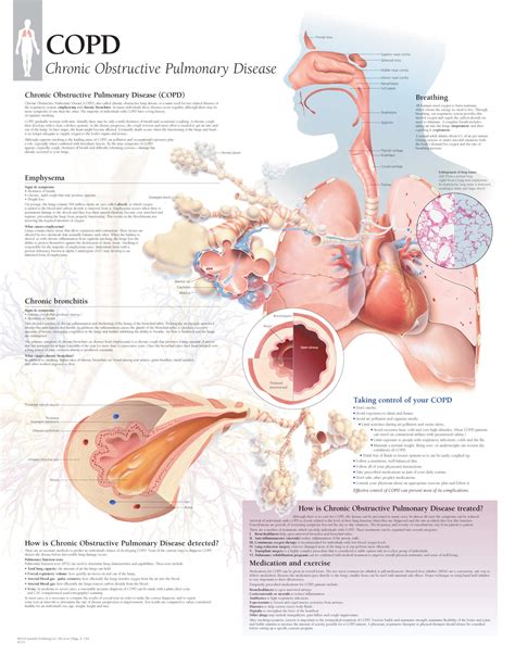 COPD - Scientific Publishing