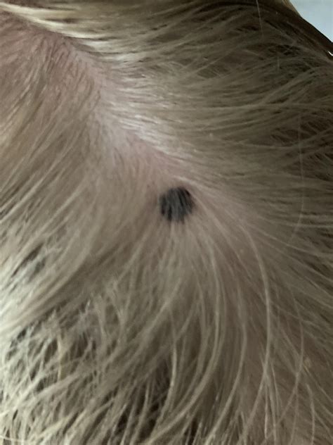 Had it for a while but it feels like it’s growing. getting pins and