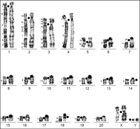 Paired Chromosomes Of Half R Banded Left And G Banded Right