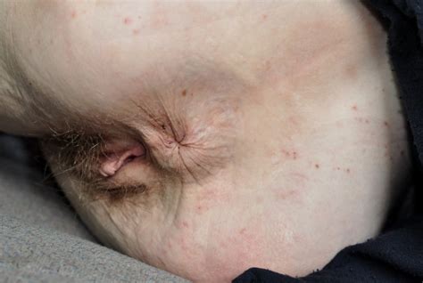 Dirty Junkie Whores 34 Porn Pictures XXX Photos Sex Images 3962782 PICTOA