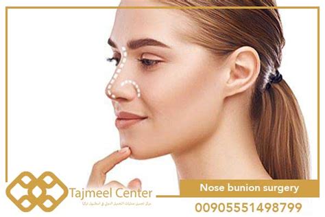 Nose Bunion Surgery Istanbul International Beauty Center