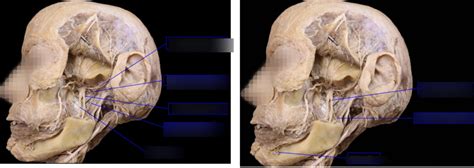 Anatomy Lab Cadaveric Dissection Diagram Quizlet