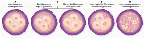 Embryo Grading, Blastocyst Implantation, Blastocyst Grading