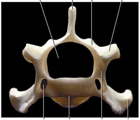 Cat Skeletal System Figure 53 24 Cervical Vertebra Diagram Quizlet