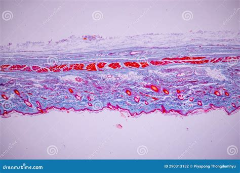 Characteristics Tissue Of Human Scalp Skin Human From General Body