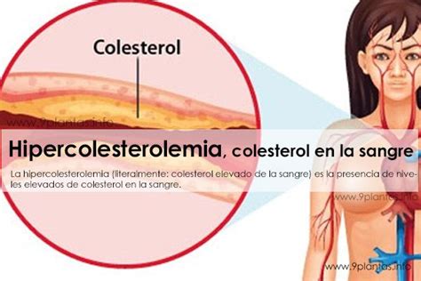 Hipercolesterolemia Colesterol En La Sangre 9plantas Colesterol