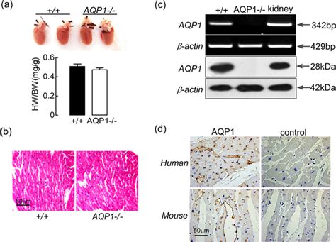 Normal Cardiac Morphology And The Expression Of AQP1 In AQP1 And