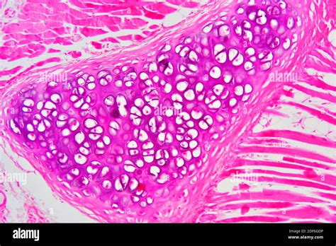 Hyaline Cartilage From Trachea Showing Chondrocytes Collagen Fibers