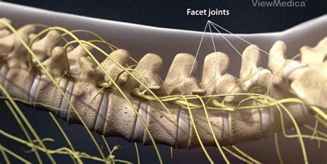 Side Effects Of Facet Joint Injections | Florida Surgery Consultants