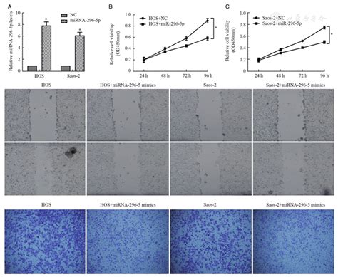 Corrigendum Mirna P Functions As A Potential Tumor Suppressor In