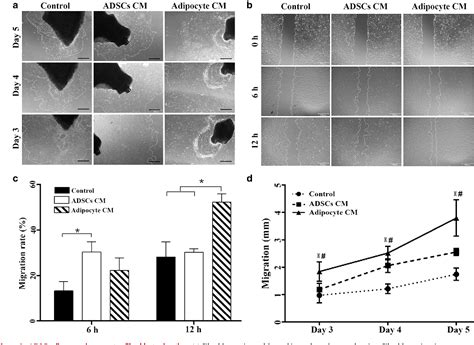 Figure 2 From Hydrogel From Acellular Porcine Adipose Tissue Accelerates Wound Healing By