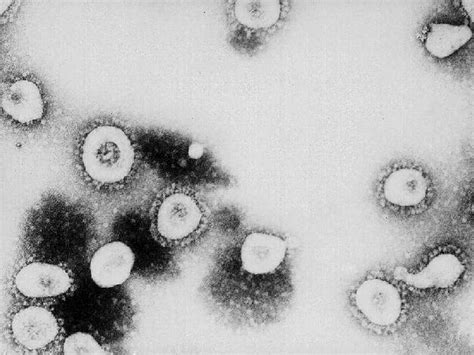 The Coronavirus Is Not A Man Made Biological Weapon The Washington Post