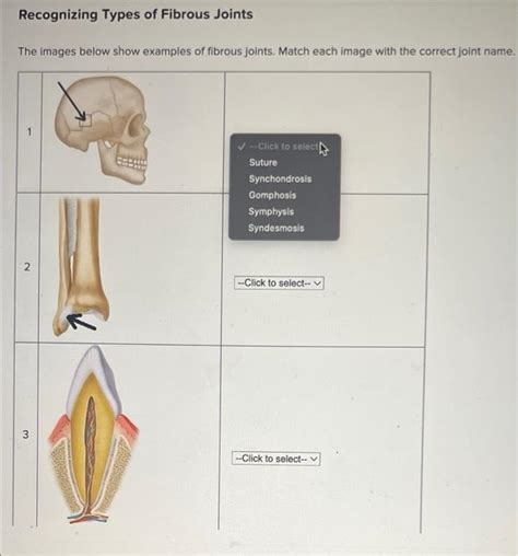 [Solved]: Recognizing Types of Fibrous Joints The images be