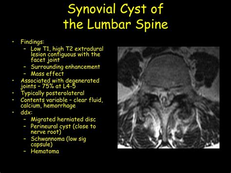 Ppt Anoxic Brain Injury Powerpoint Presentation Free Download Id 9709070