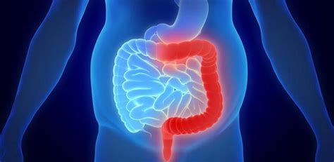 Enfermedad inflamatoria intestinal causas síntomas diagnóstico y