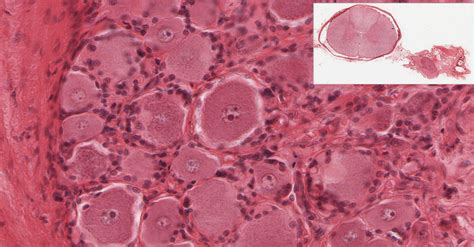 Peripheral Nerve Histology Cross Section