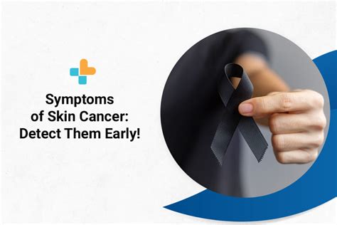 Symptoms Of Skin Cancer: Detect Them Early!