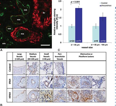 Circulating Angiogenic Modulatory Factors Predict Survival And