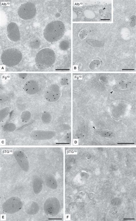 Immunolabeling Of Control And Gray Platelet Syndrome Gps Platelets