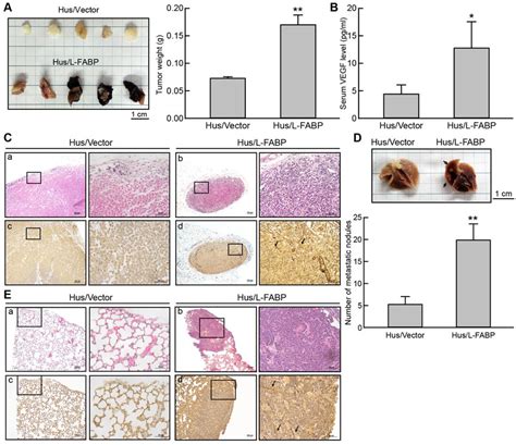 L Fabp Promotes Tumor Growth And Metastasis In Vivo Hus L Fabp Or