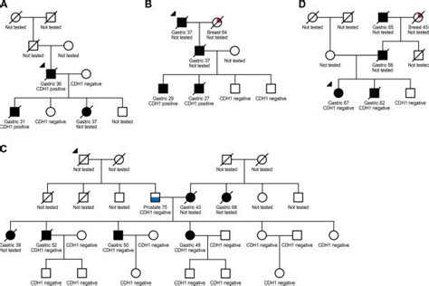 Pedigrees Of Hereditary Diffuse Gastric Cancer Families A B C