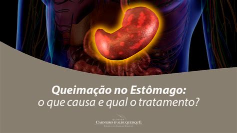 Diarreia E Queimação No Estomago - Queimação No Estômago: O Que Causa E Qual O Tratamento? - Prof Dr. Luiz ...