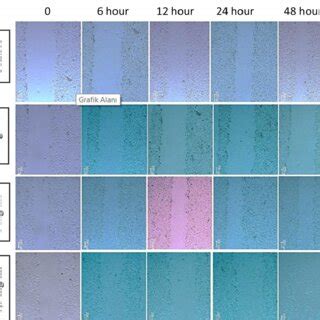 Microscopic imaging of migration and proliferation of cells at 0-48 ... 