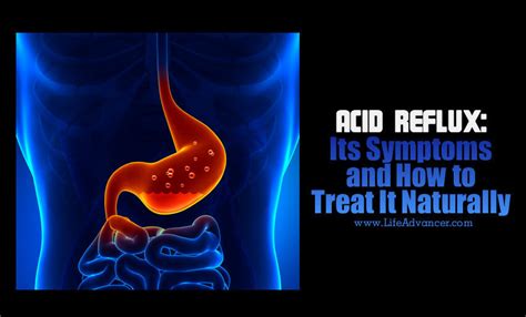 Acid Reflux: Its Symptoms and How to Treat It Naturally