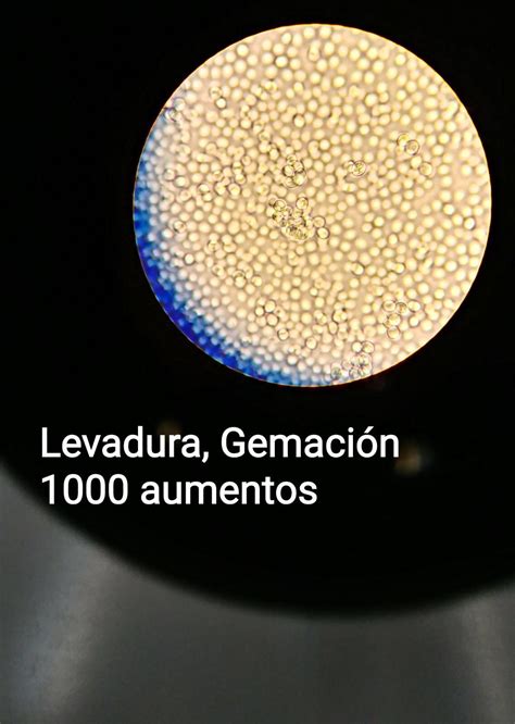 Ismaelmicrobiologia Observación de levaduras al microscopio