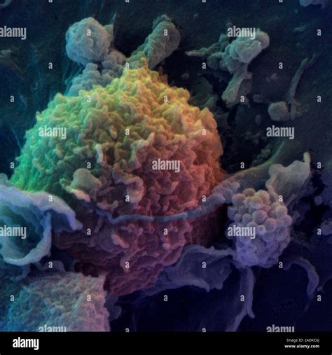 Dendritic And T Cells Coloured Scanning Electron Micrograph Sem Of